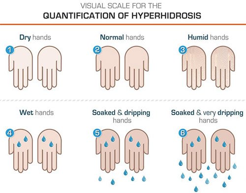 Hyperhidrosis • LA Longevity