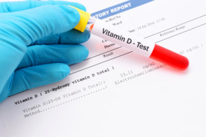 Vitamin D blood test